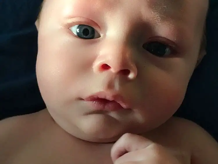 Forehead, Nose, Cheek, Skin, Lip, Chin, Eyebrow, Eyelash, Mouth, Human Body, Jaw, Iris, Gesture, Stomach, Baby, Thumb, No Expression, Chest, Toddler, Trunk